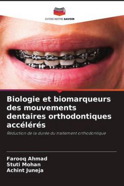 Biologie et biomarqueurs des mouvements dentaires orthodontiques accélérés