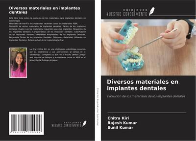 Diversos materiales en implantes dentales