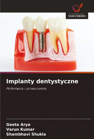 Implanty dentystyczne