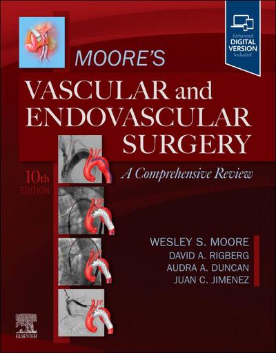 Moore’s Vascular and Endovascular Surgery: A Comprehensive Review