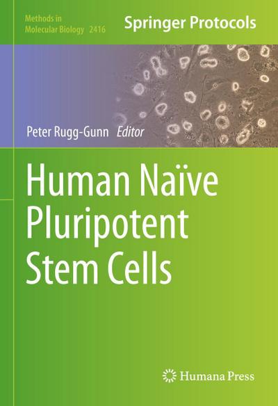 Human Naïve Pluripotent Stem Cells