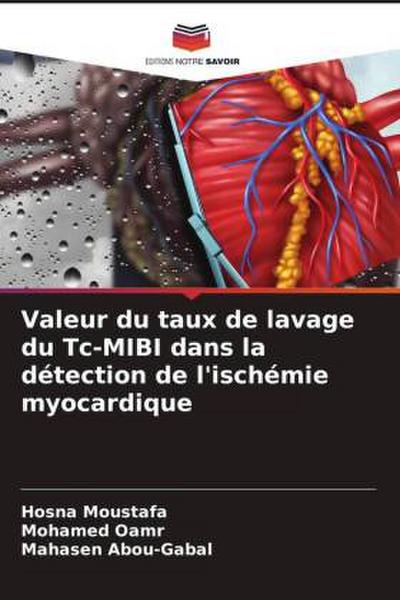 Valeur du taux de lavage du Tc-MIBI dans la détection de l’ischémie myocardique