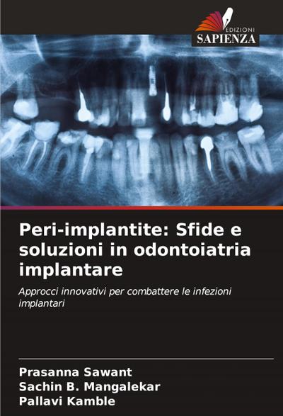 Peri-implantite: Sfide e soluzioni in odontoiatria implantare