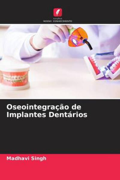 Oseointegração de Implantes Dentários