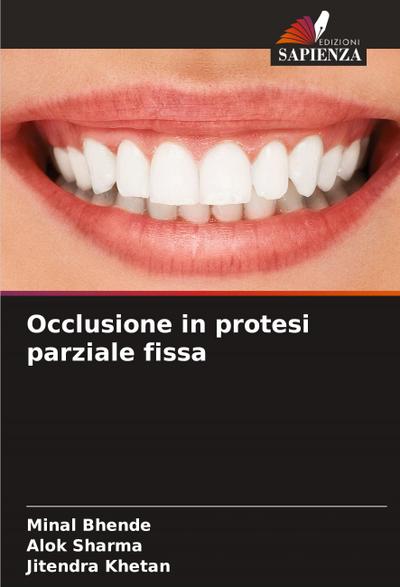 Occlusione in protesi parziale fissa