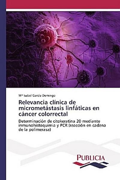 Relevancia clínica de micrometástasis linfáticas en cáncer colorrectal
