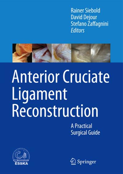 Arthroscopic Anterior Cruciate Ligament Reconstruction