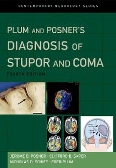Plum and Posner’s Diagnosis of Stupor and Coma
