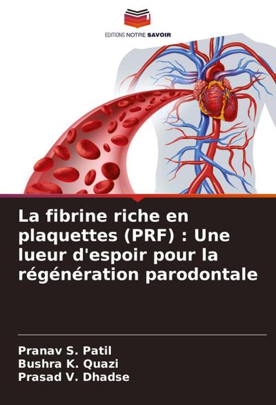 La fibrine riche en plaquettes (PRF) : Une lueur d’espoir pour la régénération parodontale