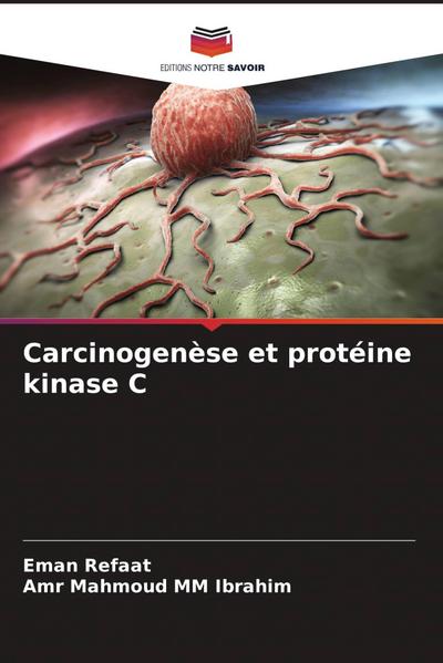 Carcinogenèse et protéine kinase C