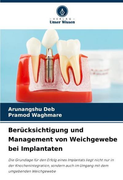 Berücksichtigung und Management von Weichgewebe bei Implantaten