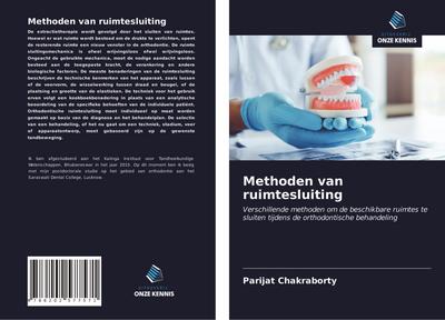 Methoden van ruimtesluiting