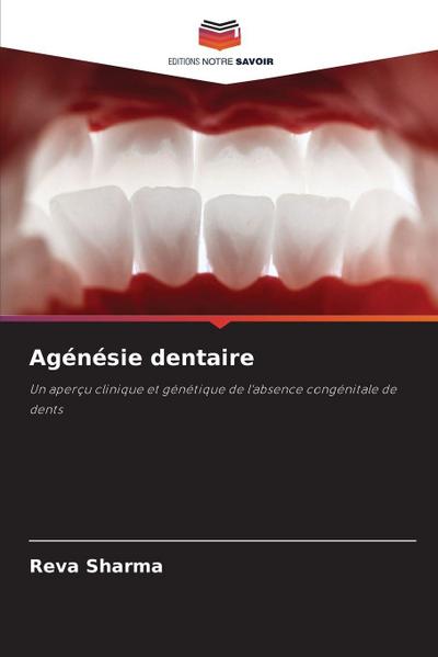 Agénésie dentaire