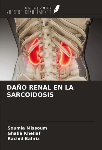 DAÑO RENAL EN LA SARCOIDOSIS