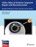 Video Atlas of Anterior Segment Repair and Reconst