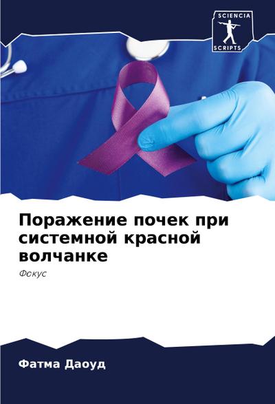 Porazhenie pochek pri sistemnoj krasnoj wolchanke