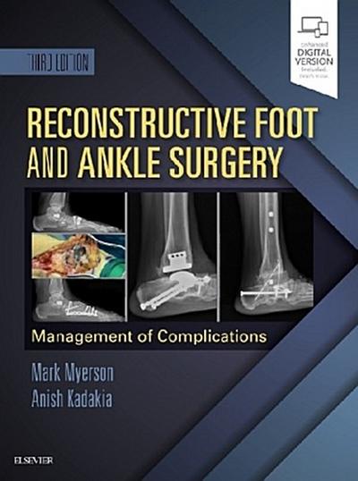 Reconstructive Foot and Ankle Surgery: Management of Complications