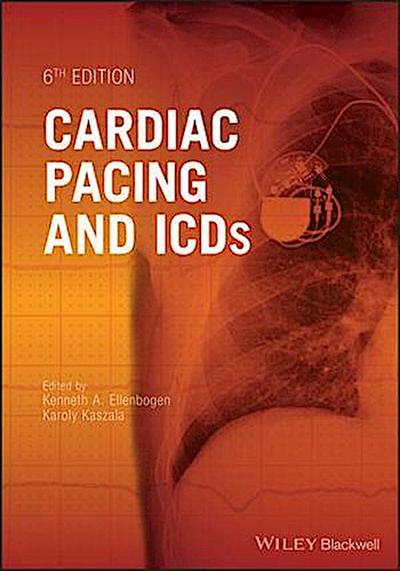 Cardiac Pacing and ICDs