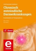 Chronisch entzündliche Darmerkrankungen - Krankheitsbild und Therapieoptionen