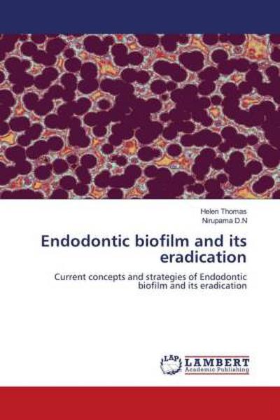 Endodontic biofilm and its eradication
