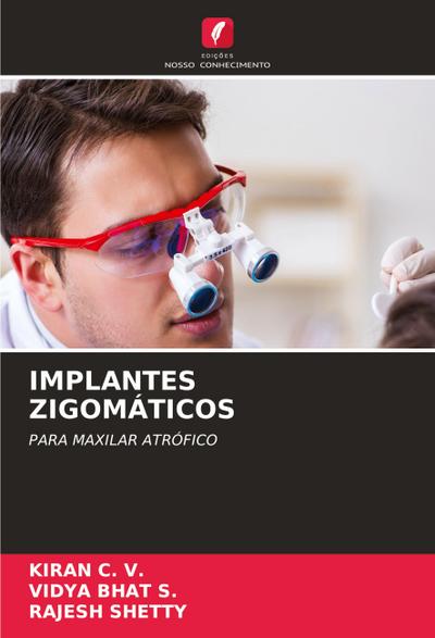 IMPLANTES ZIGOMÁTICOS