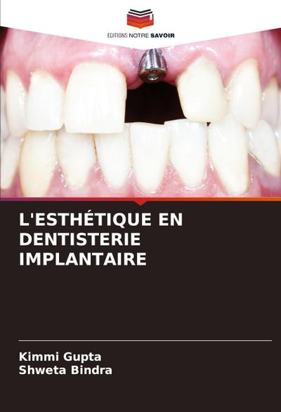 L’ESTHÉTIQUE EN DENTISTERIE IMPLANTAIRE