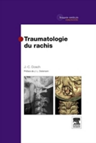 Traumatologie du rachis