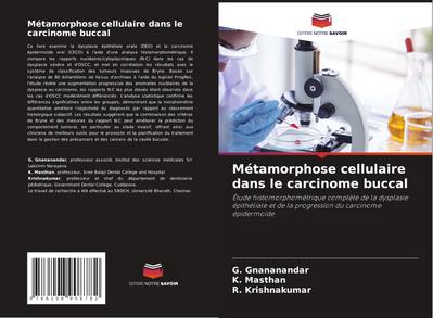 Métamorphose cellulaire dans le carcinome buccal