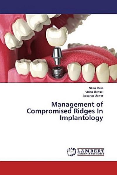 Management of Compromised Ridges In Implantology