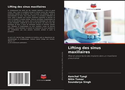 Lifting des sinus maxillaires