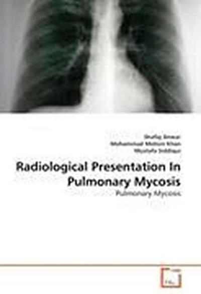 Radiological Presentation In Pulmonary Mycosis