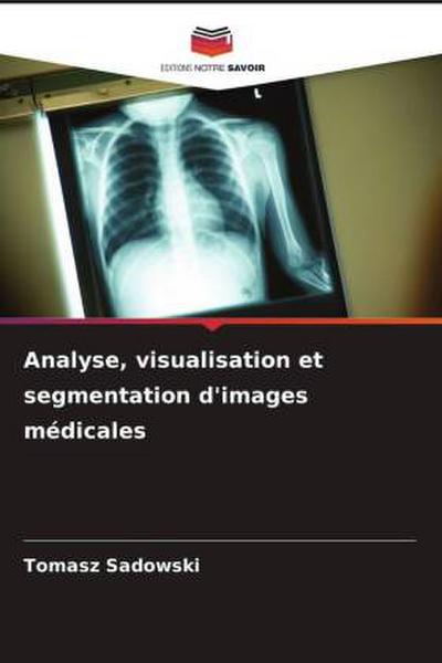 Analyse, visualisation et segmentation d’images médicales