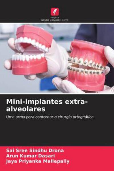 Mini-implantes extra-alveolares