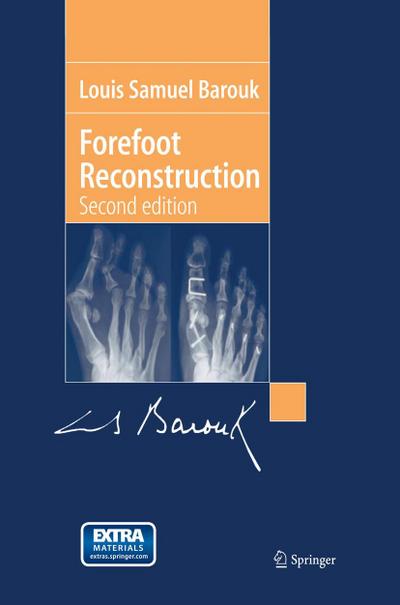 Forefoot Reconstruction