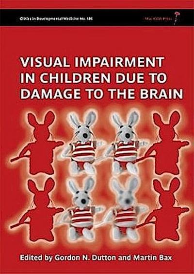 Visual Impairment in Children Due to Damage to the Brain