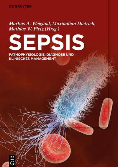 Sepsis