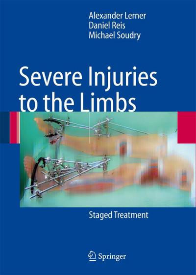 Severe Injuries to the Limbs