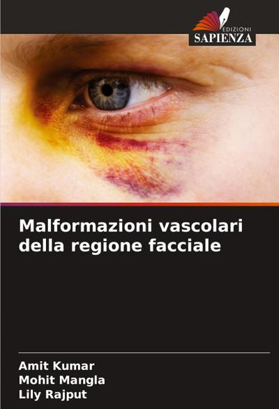 Malformazioni vascolari della regione facciale