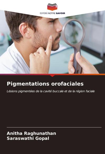 Pigmentations orofaciales