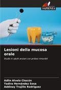 Lesioni della mucosa orale