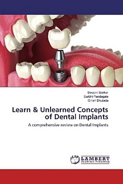 Learn & Unlearned Concepts of Dental Implants