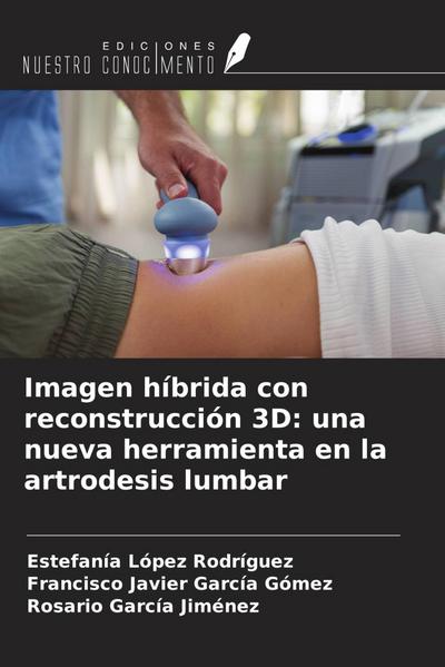 Imagen híbrida con reconstrucción 3D: una nueva herramienta en la artrodesis lumbar