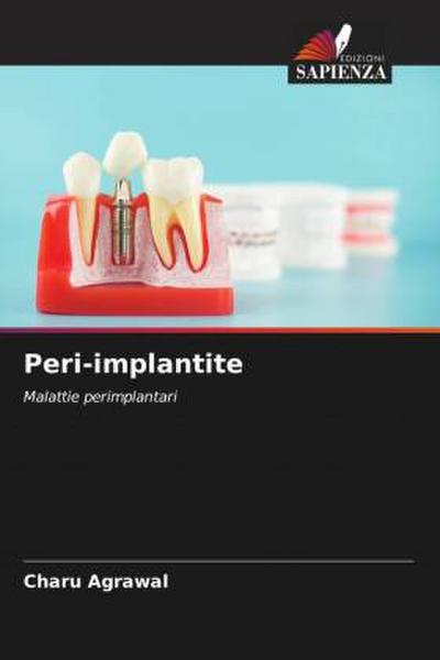 Peri-implantite