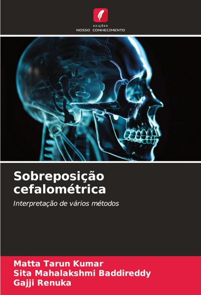 Sobreposição cefalométrica