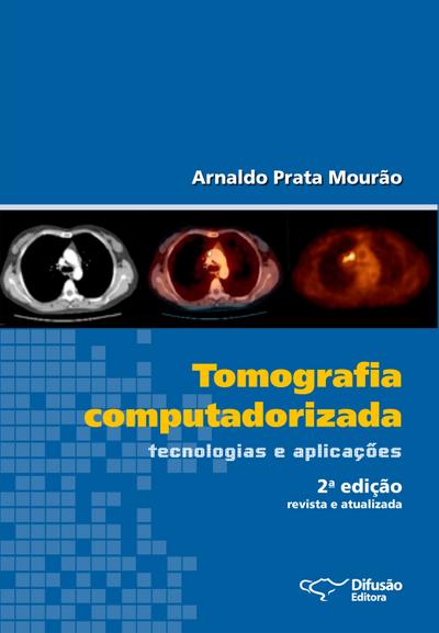 Tomografia computadorizada