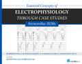 Essential Concepts of Electrophysiology through Case Studies: Intracardiac EGMs