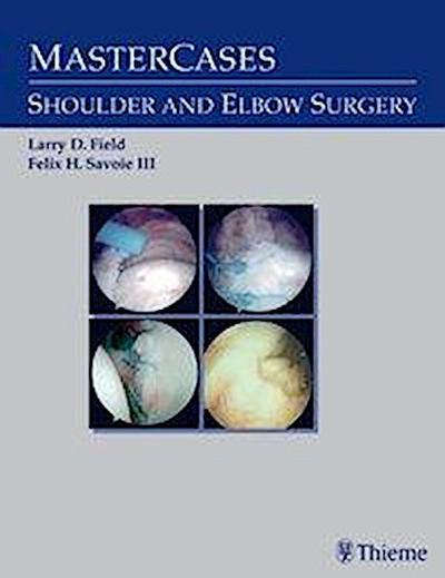 Field, L:  MasterCases in Shoulder and Elbow Surgery