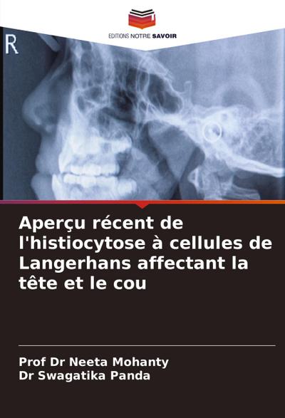 Aperçu récent de l’histiocytose à cellules de Langerhans affectant la tête et le cou