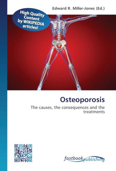 Osteoporosis - Edward R. Miller-Jones