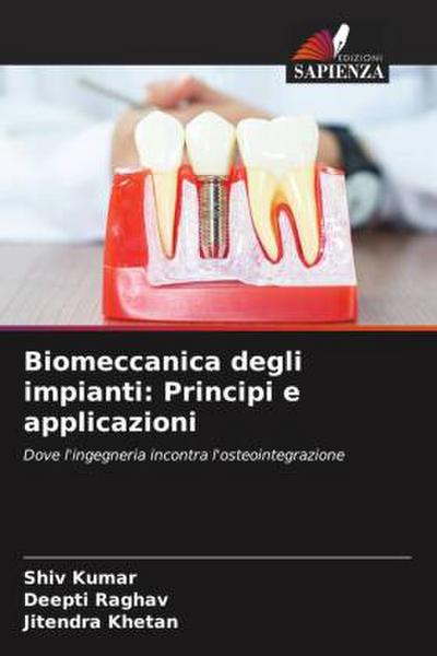 Biomeccanica degli impianti: Principi e applicazioni